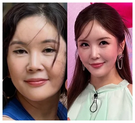 장영란-2 (출처: 인스타그램)